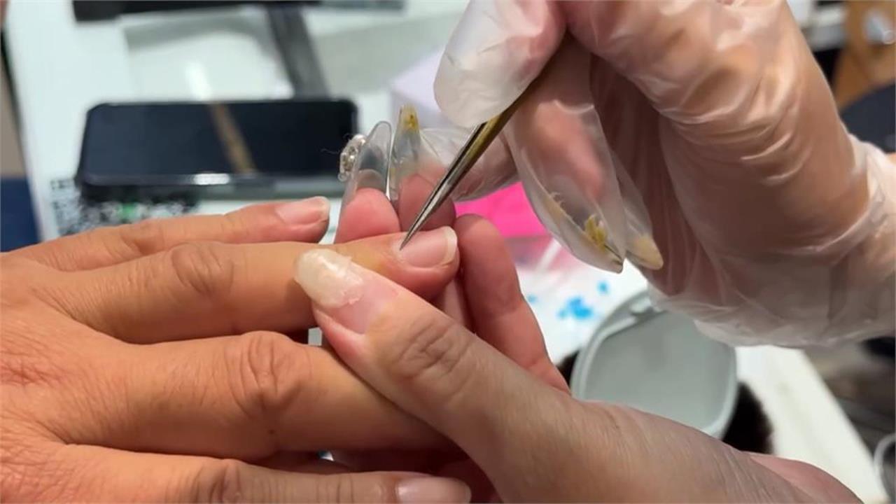 指甲易斷竟是身體警訊？醫曝補救「必吃菜單」