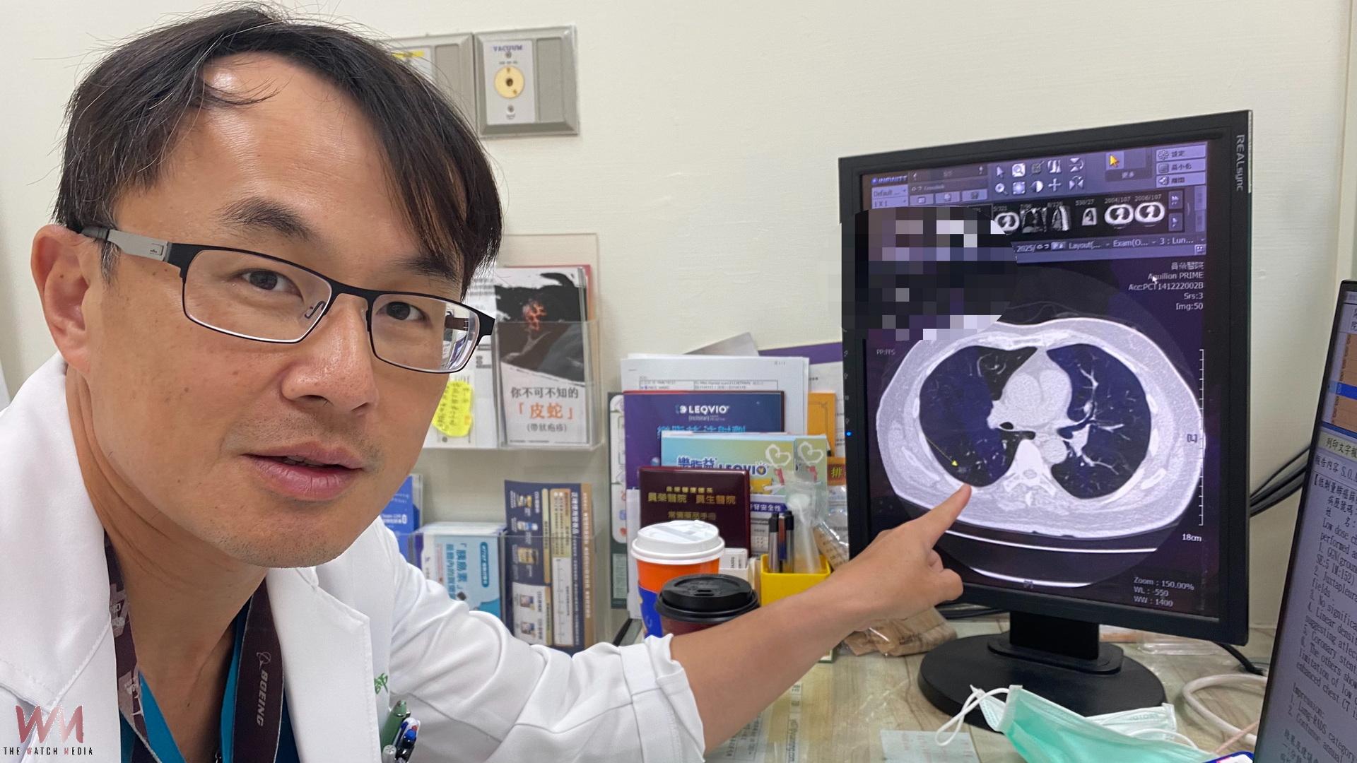 為孫戒菸　66歲男子肺癌早期切除　意外救了自己一命