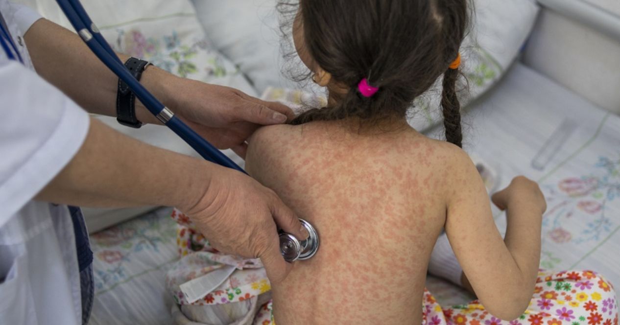 麻疹群聚感染匡列526人！日本疫情創7年新高　赴WBC觀賽注意