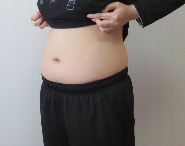 體重標準…卻有脂肪肝？營養師：肚子凸是內臟脂肪爆滿