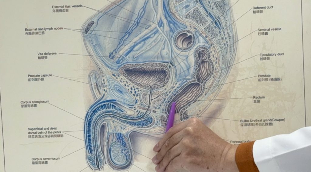 攝護腺刮過 10年後仍罹癌