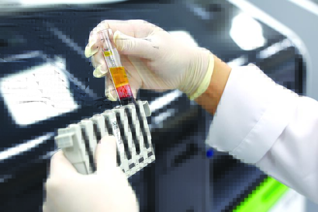 數據失靈－數據正常為何仍猝死？