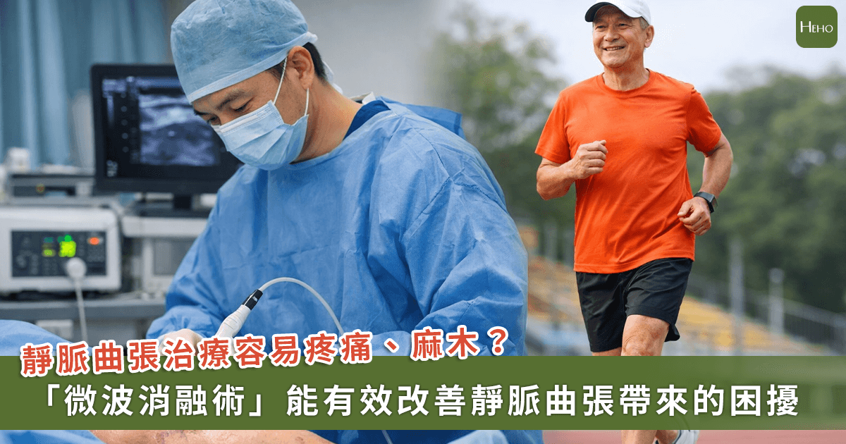 靜脈曲張治療易疼痛、麻木？醫師解析新術式「微波消融術」，助小腿從痠脹腫痛變為輕盈步伐