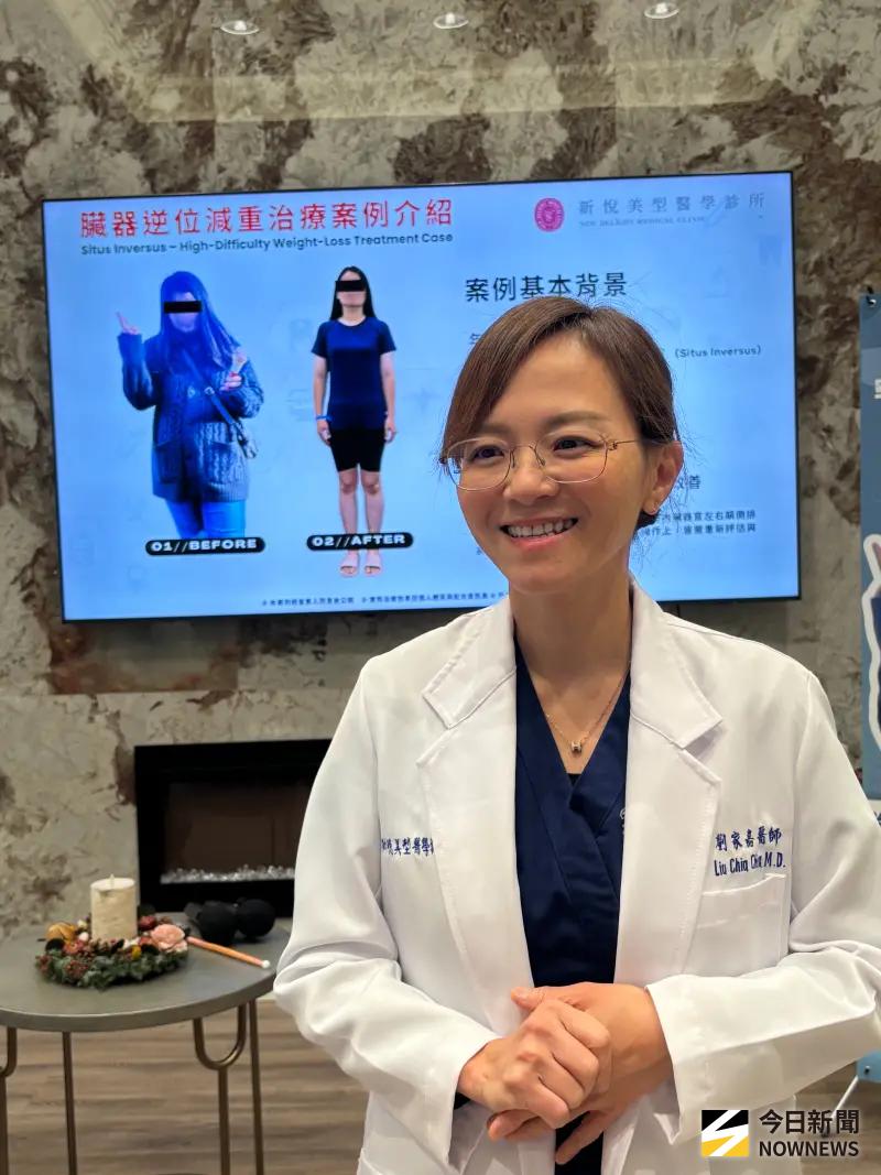 全球第二例 「鏡面人」靠ESG半年甩肉22公斤