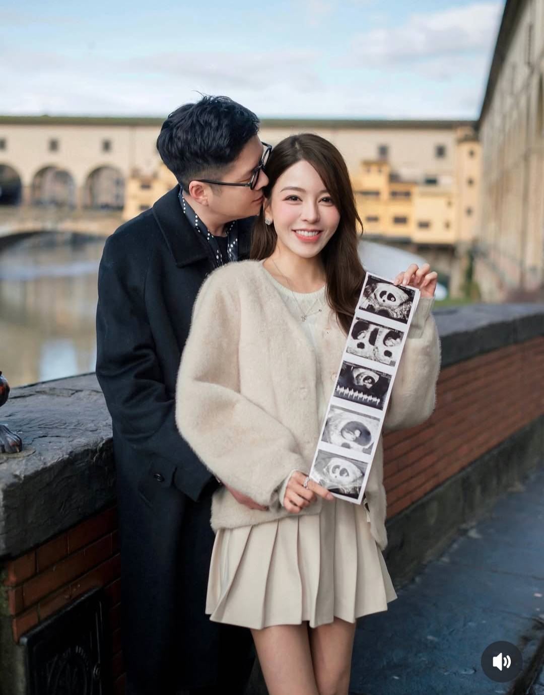 女星試管懷雙胞胎！求子壓力大到「鬼剃頭」　爆併發症：腹腔都腹水