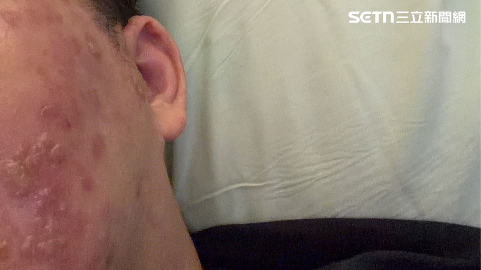 牙痛失眠不是「牙」！3天竟引「蛇」出...