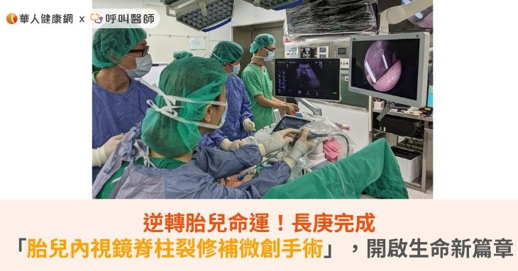 逆轉胎兒命運！長庚完成「胎兒內視鏡脊柱裂修補微創手術」，開啟生命新篇章