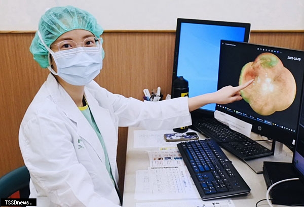 超廣角眼底攝影盡收眼底影像 周邊網膜裂孔、退化病變 全掌握