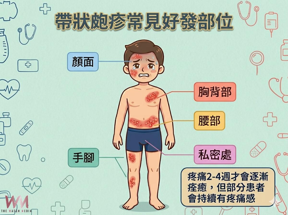 皮蛇痛起來要人命　接種疫苗有效改善發病後的疼痛感