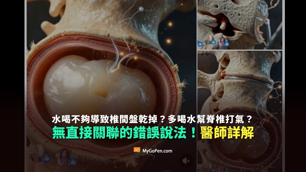 【錯誤】網傳水喝不夠導致椎間盤乾掉？多喝水幫脊椎打氣？無直接關聯的說法！醫師詳解